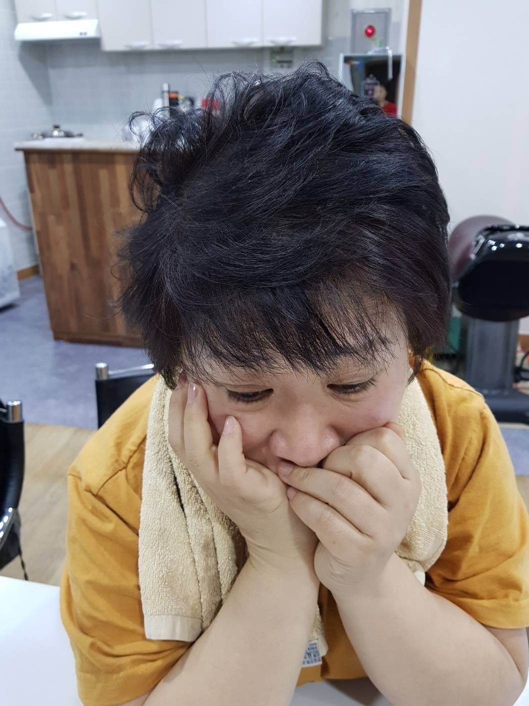 薄毛改善（女性） 施術後